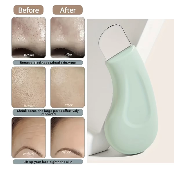 Blackhead and Whitehead Removal Tool for Nose and Face - Skin Pore Cleaner Skin Care Tools for Women - AliExpress 66