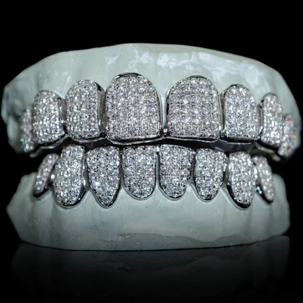 Iced VVS Moissanite Grillz Gold Top Bottom by Custom Gold Grillz