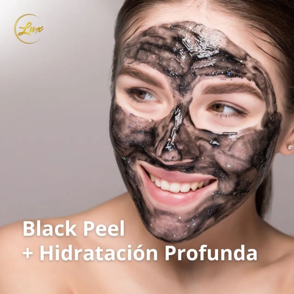 Black Peel: Peeling Laser sin descamación + Hidratación Profunda