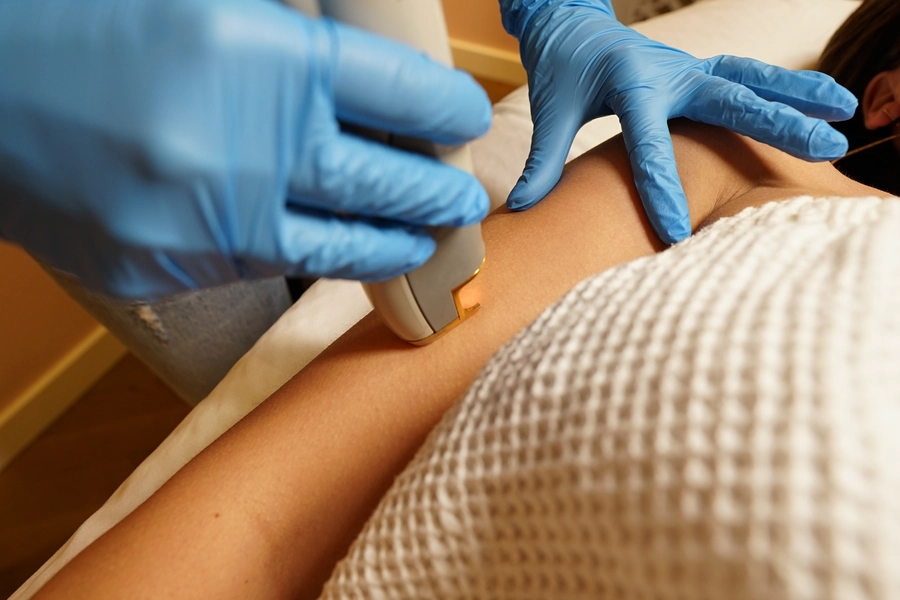 Laser Hair Removal Prices & Consultations | Portland & Beaverton