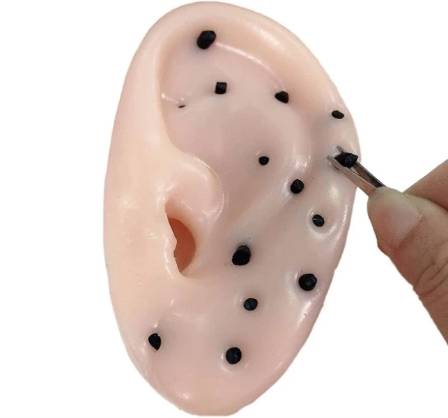 1pc Ear-Shaped Blackheads Removal & Pimple Popping Toy