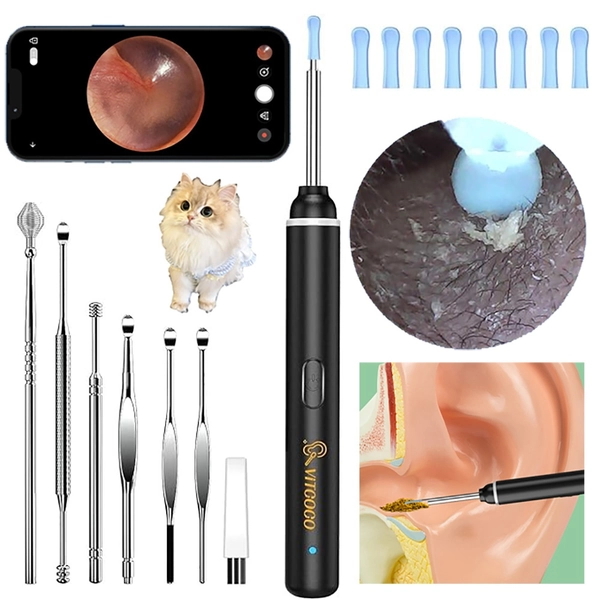 Professional 1920P HD Ear Wax Removal Camera Tool 6 Adjustable LED Lights & 8 Safe Ear Spoons Ear Cleaning Kit for iPhone, iPad, Android Perfect for Home, Travel, Kids & Elderly Care,  Home Ear Care, Compact Design, Medicalgrade, Ear Hygiene Device